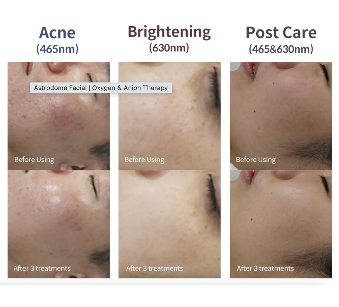 Astrodome Facial | Oxygen & Anion Therapy