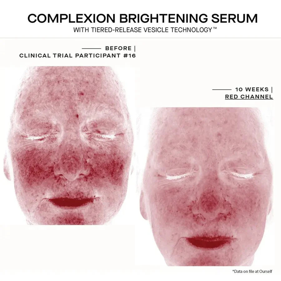 Ourself - Complexion Brightening Serum – 30 mL