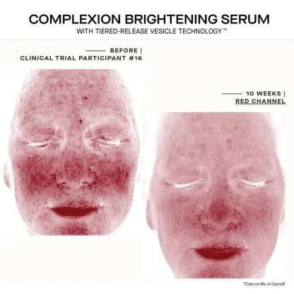Ourself - Complexion Brightening Serum – 30 mL